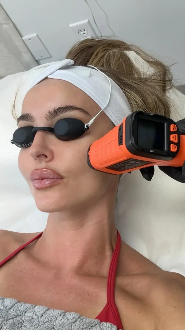 You’ve been told lasers = downtime. This one doesn’t ⚡️
.
Laser Genesis with NP @skinbysogol 
.
📍 Skin Spa New York, Mi